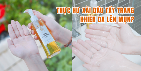 Thực hư xài dầu tẩy trang khiến da lên mụn?