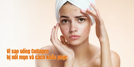 Vì sao uống Collagen bị nổi mụn và cách khắc phục