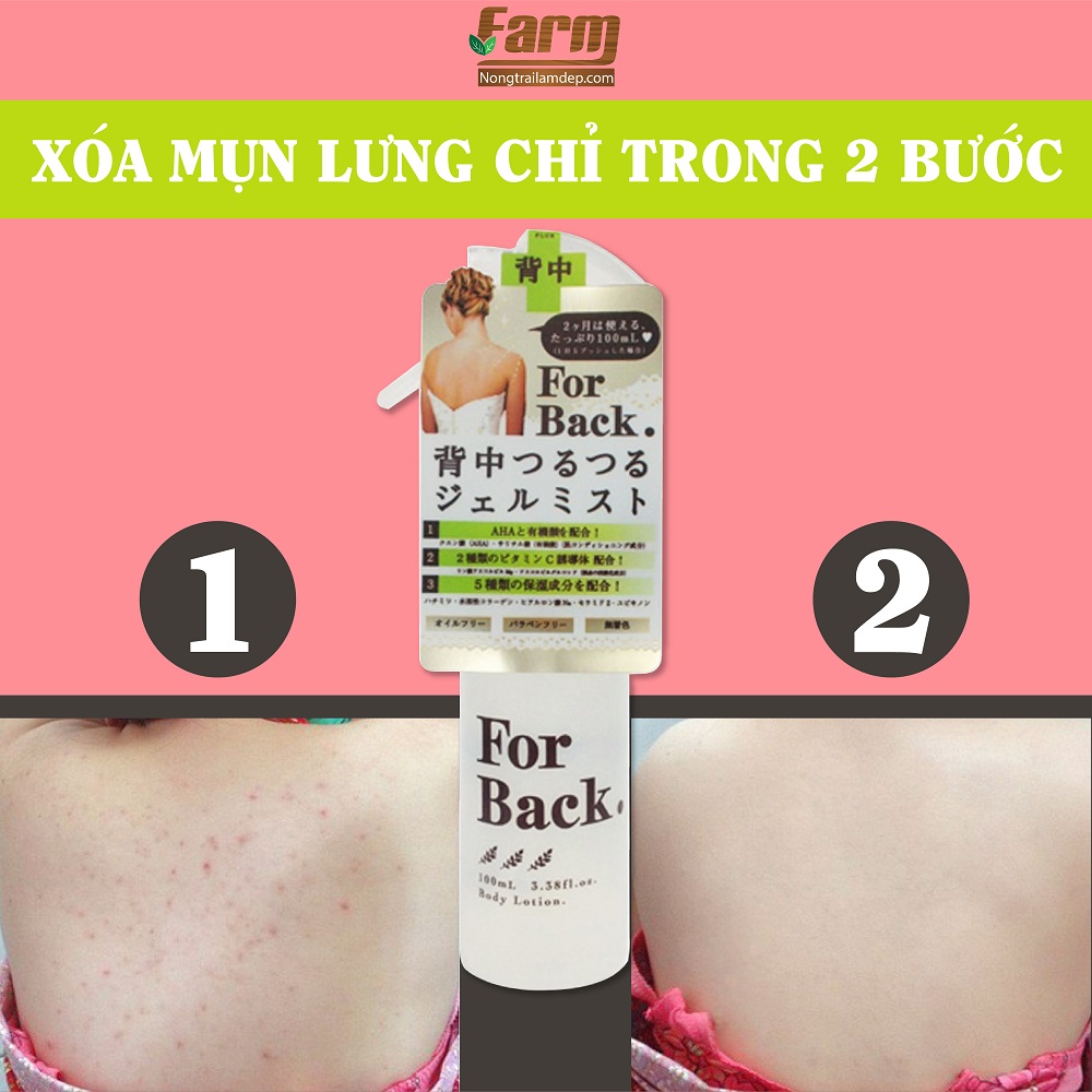 Xịt Trị Mụn Lưng For Back