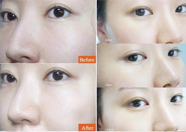 viên uống cấp nước, collagen aquarich 