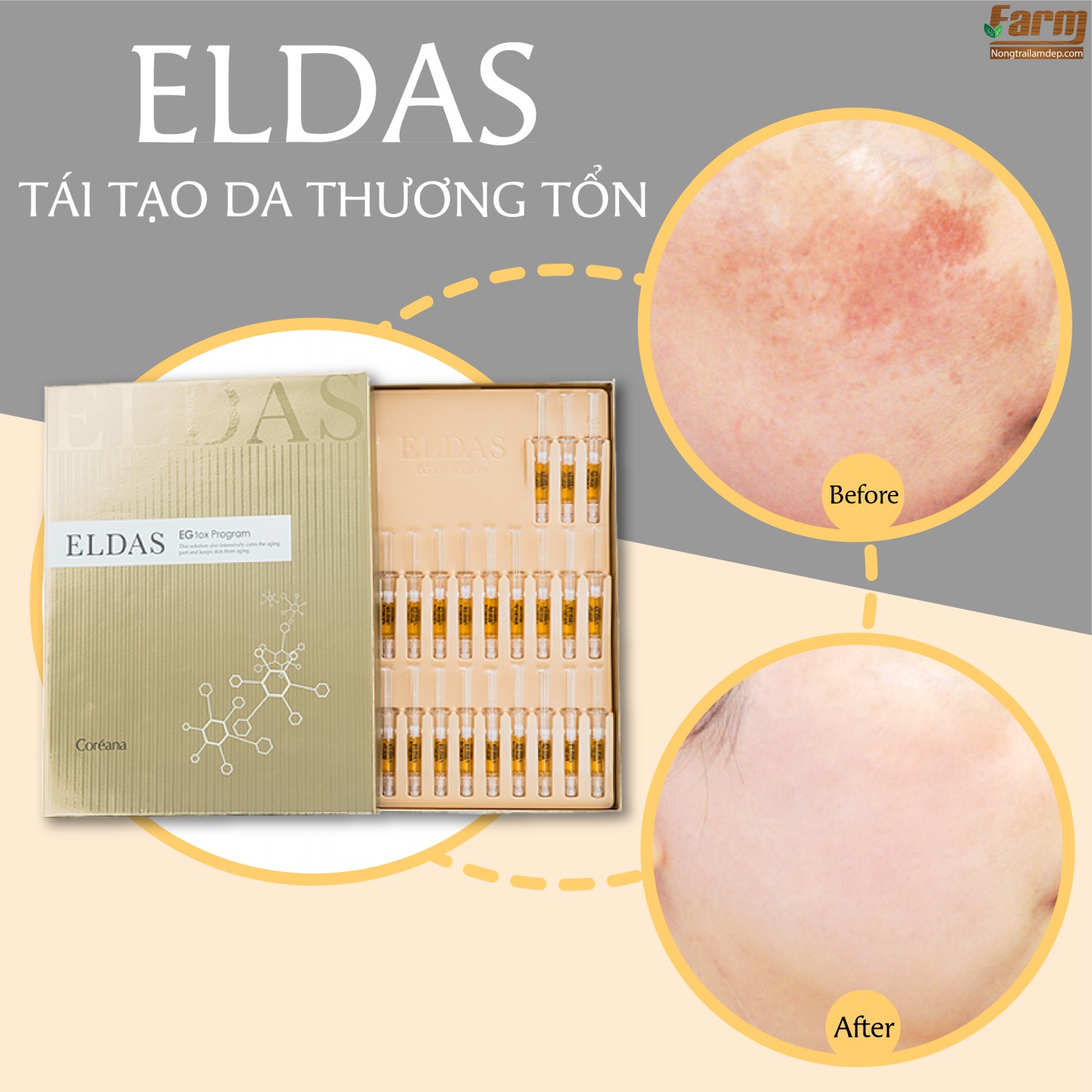 Tế Bào Gốc Dưỡng Trắng Trẻ Hóa Eldas 