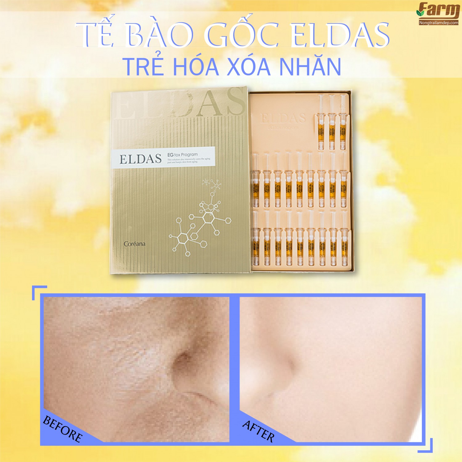 Tế Bào Gốc Dưỡng Trắng Trẻ Hóa Eldas 