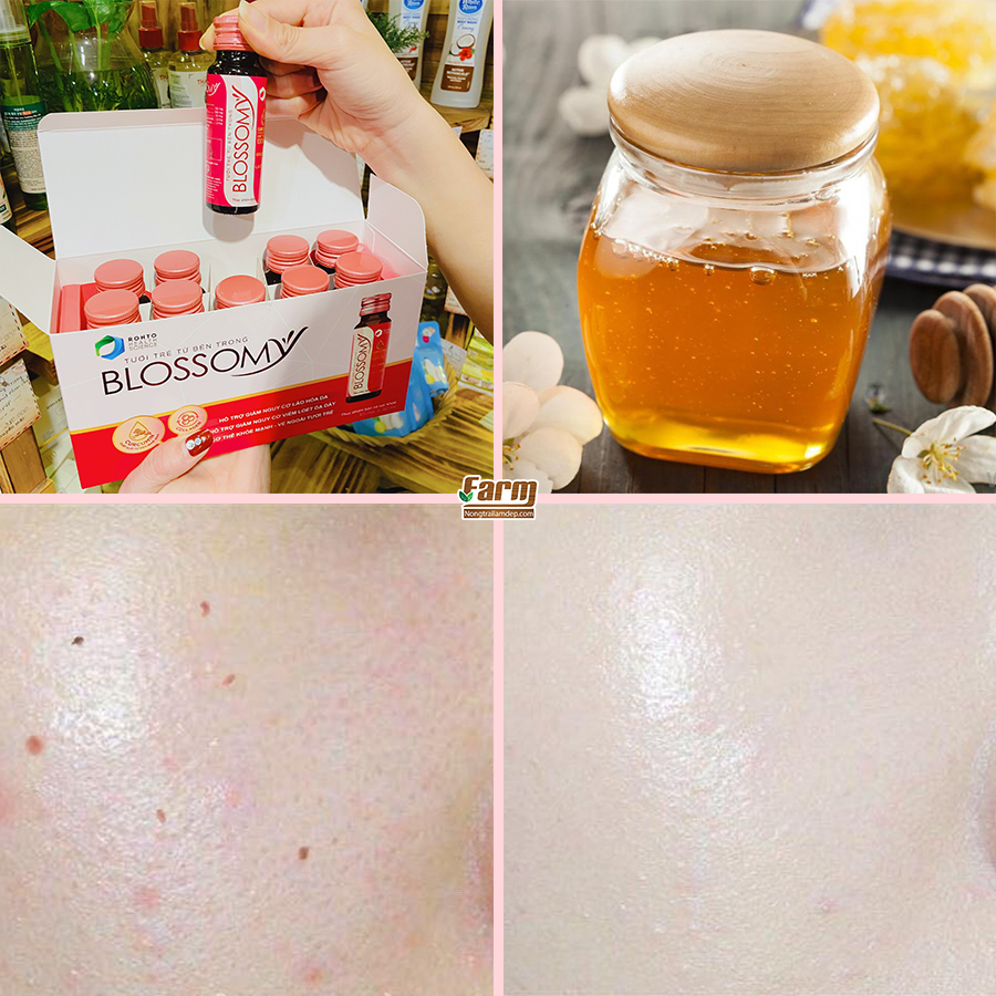 Nước Uống Đẹp Da Collagen Blossomy 