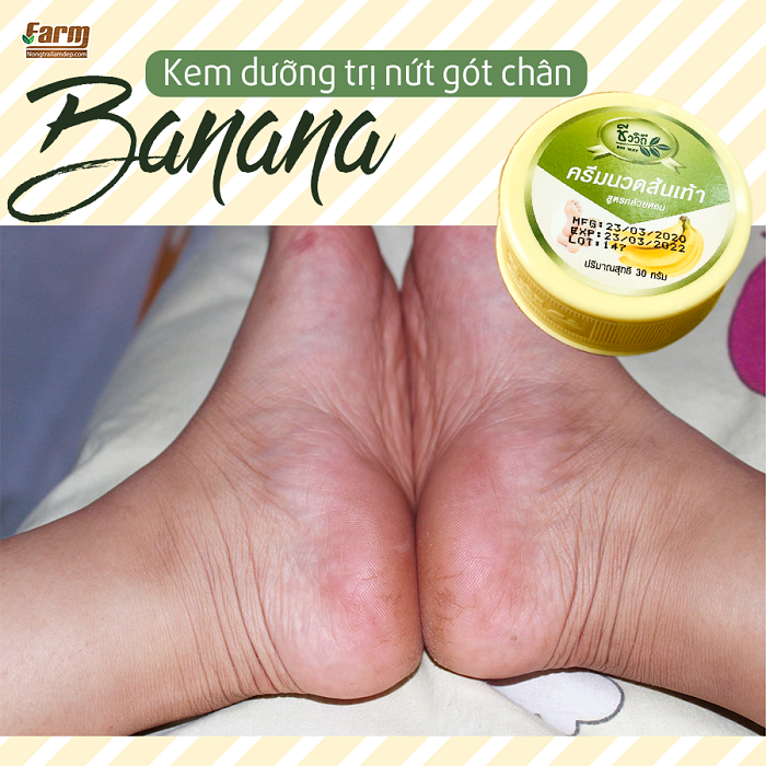 Kem Trị Nứt Gót Chân The Banana Cream Heels Thái Lan 7