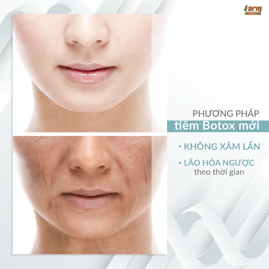 SERUM NỌC ONG 04