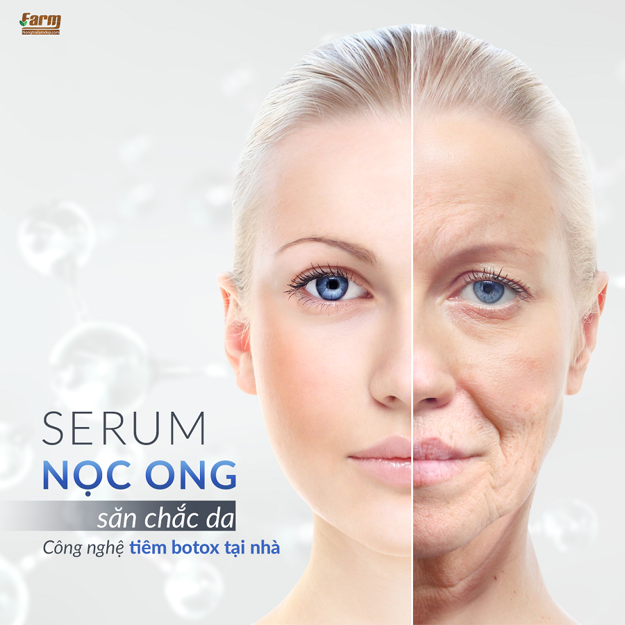 SERUM NỌC ONG 05