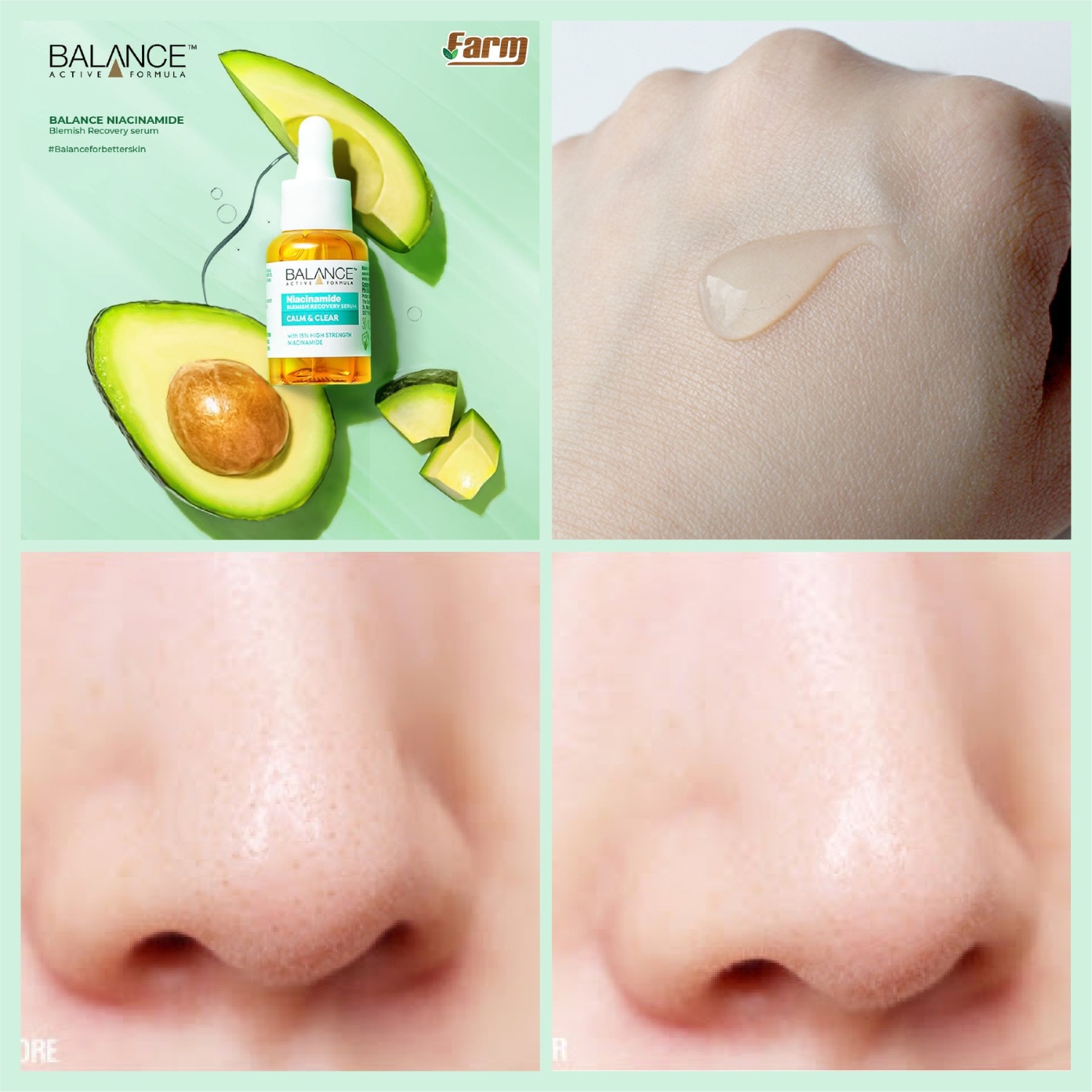 Tinh chất Serum Balance Niacinamide 15% Blemish Recovery