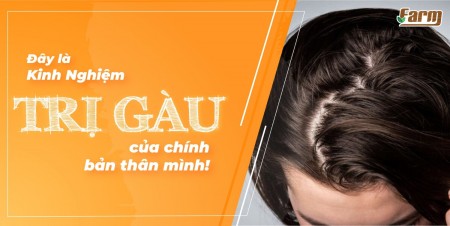 ĐÂY LÀ KINH NGHIỆM TRỊ GÀU CỦA CHÍNH BẢN THÂN MÌNH