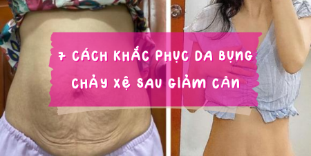 7 cách khắc phục da bụng chảy xệ sau giảm cân