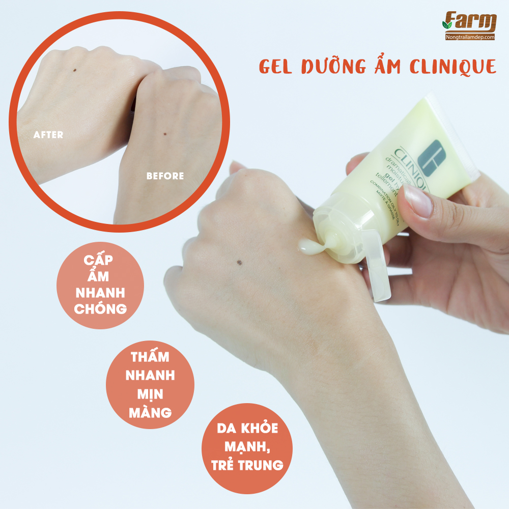 gel dưỡng ẩm clinique