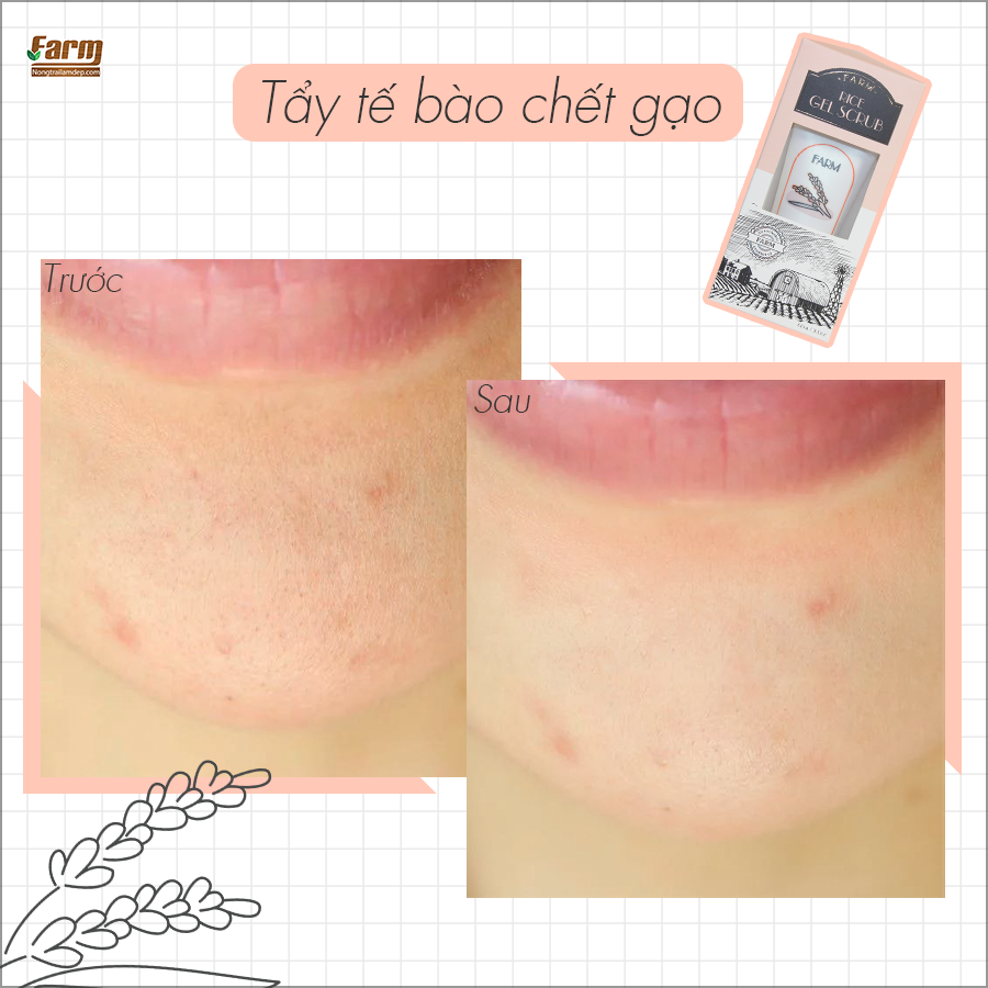 Tẩy Tế Bào Chết Từ Gạo Thiên Nhiên