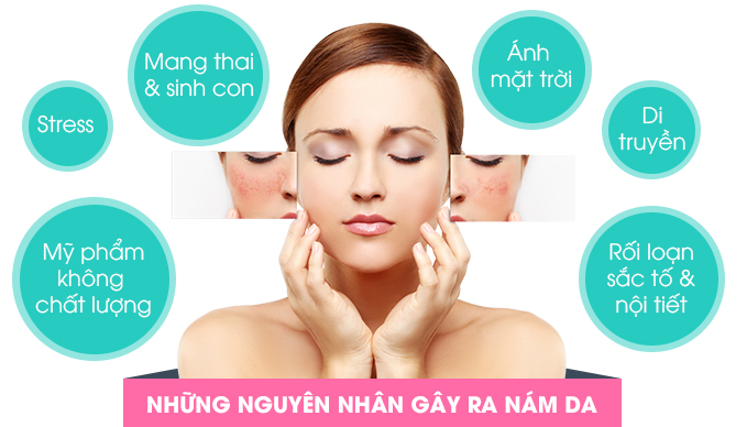 nguyên nhân nám