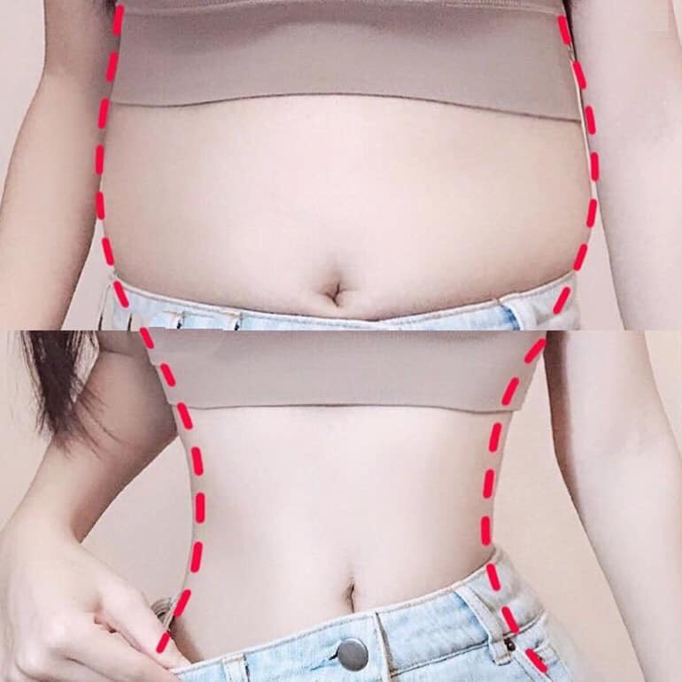 Sử dụng gel tan mỡ như thế nào để đạt hiệu quả tốt nhất?