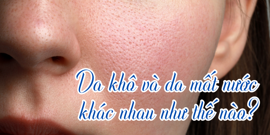 Da khô và da mất nước khác nhau như thế nào?