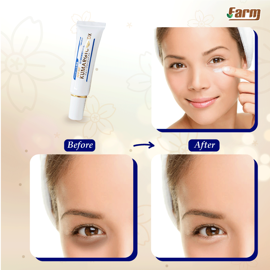 Kumargic eye cream