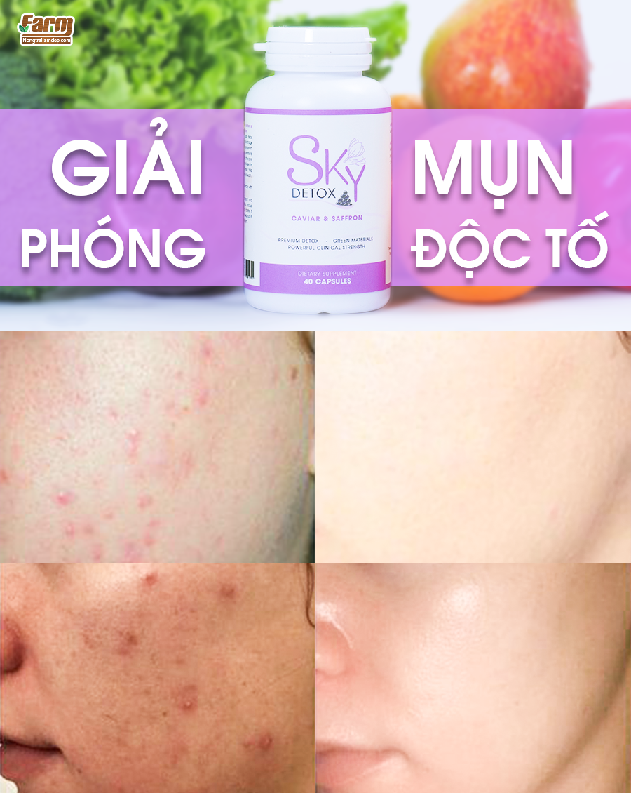 Viên uống giảm cân và thải độc SKY DETOX