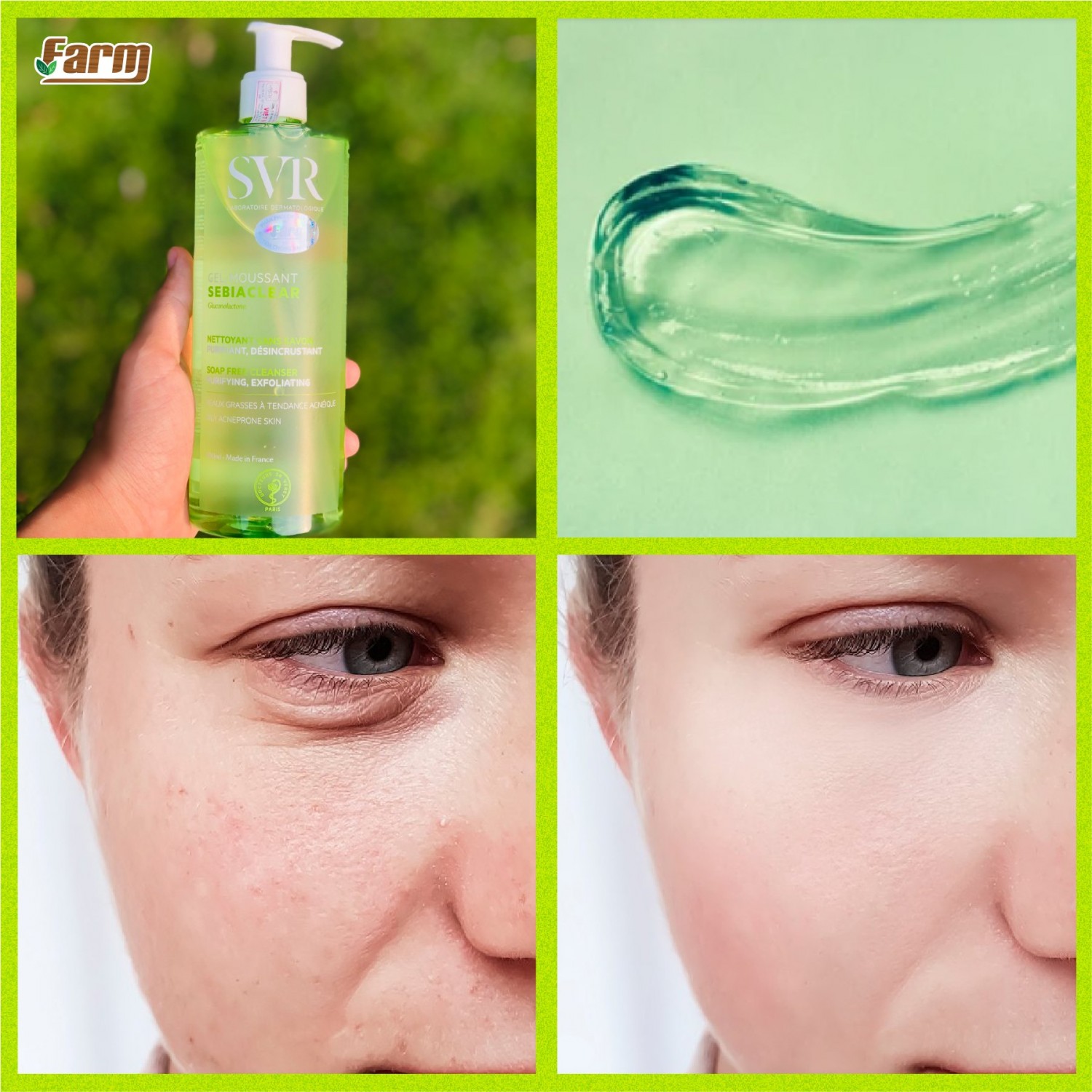 GEL RỬA MẶT TẠO BỌT CHO DA DẦU MỤN SVR SEBIACLEAR GEL MOUSSANT